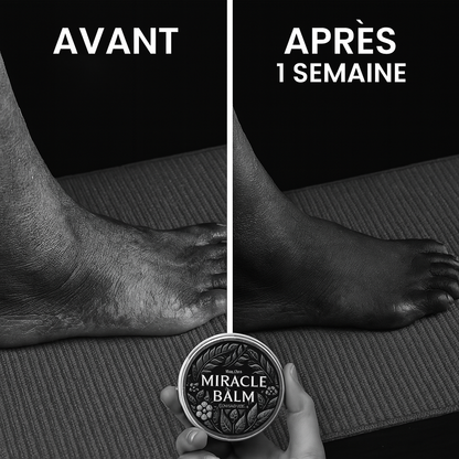 Miracle Balm – Soulage varices, jambes lourdes, douleurs et brûlures aux pieds, neuropathie dès la première application